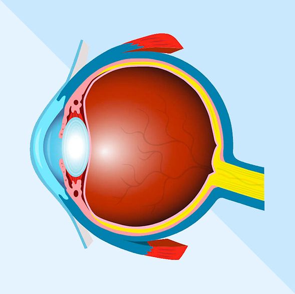 Lens_Guides_row_5_banner_3