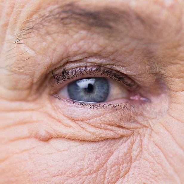 Where_does_eye_colour_come_from_row_7