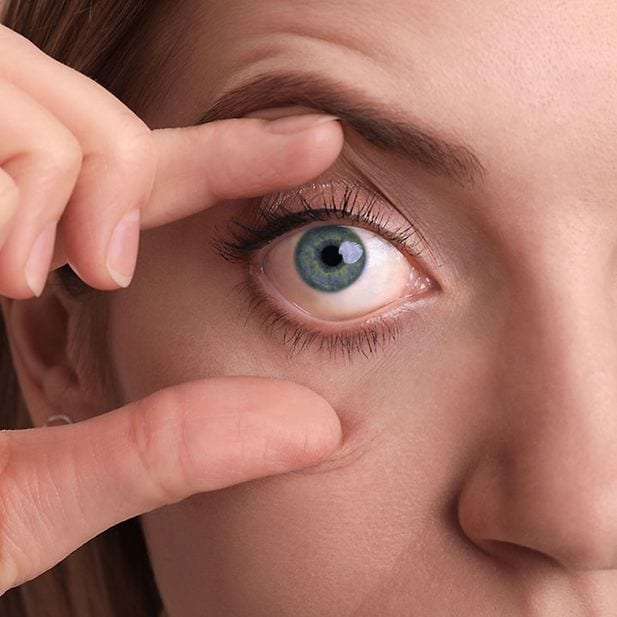 Eye_infections_and_contact_lenses_row_9