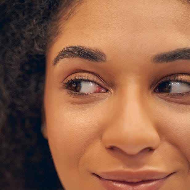 Visage d’une femme regardant sur sa droite. Elle sourit.